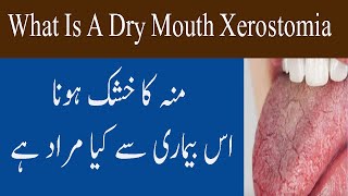 What Is Dry Mouth Xerostomia Condition In Urdu Hindi Muh Khushk Hona Ki Bimari [upl. by Viscardi753]