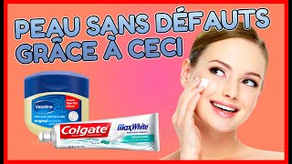 astuce simple pour soigner les imperfections et infections de la peau [upl. by Gerrit]