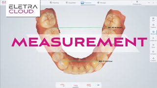 ELETRA SMART Intraoral Scanner Training  Measurement  Digital Dentistry [upl. by Gertie]