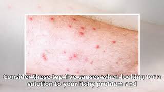 Red Bumps on Legs How to Recognize the Symptoms and Learn the Treatments [upl. by Conover]