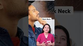 Acanthosis Nigricans Treatment  Reason of Black Neck  How to Treat Black Neck  Dr Sridevi [upl. by Woo]