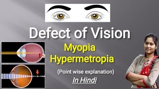 Defects of Vision  Myopia  Hypermetropia  Presbyopia  In Hindi [upl. by Riay]