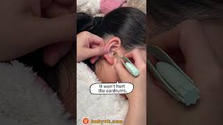 Worried About QTip Dangers Try the Baby Ear Cleaning Tool with Light babycare earwaxremoval [upl. by Elenahc]