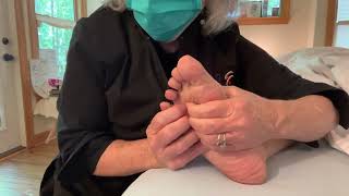 Self Treatment for Hammer Toe and Metatarsalgia [upl. by Sherline]