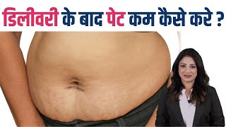 डिलीवरी के बाद पेट कम कैसे करे  How to Reduce Belly Fat after Pregnancy [upl. by Elvis]