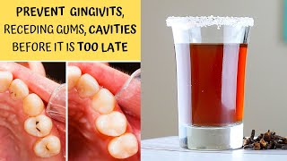 DIY Ayurvedic Mouthwash  Prevents Gingivitis Cavities Tooth Ache amp Gum Diseases [upl. by Herschel]