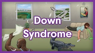 Down Syndrome Trisomy 21  USMLE Step 1 Mnemonic [upl. by Einafets733]