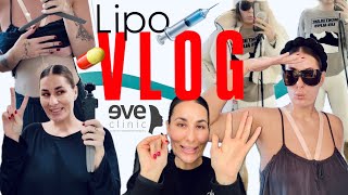 Bola som na LIPO 🤯  ZARA haul ❄️ VLOG [upl. by Charles6]