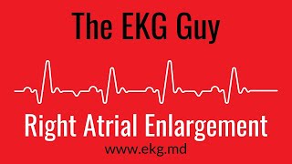 Right Atrial Enlargement EKG l The EKG Guy  wwwekgmd [upl. by Alleacim]