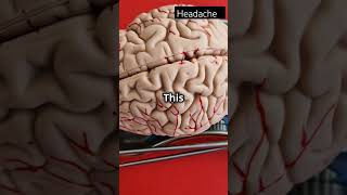 Ancient Brain Surgery Trepanation Explainedhealth science facts history surgun [upl. by Leiram]