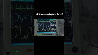 Normal Oxygen Level कितना होता है। normal oxygen level o2level o2 spo2 eicu hypoxia [upl. by Lilak]