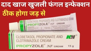 Propyzole NF Cream Uses  Clobetasol Propionate And Clotrimazole Cream  Fungul Infection दाद [upl. by Bryna837]