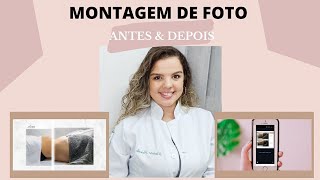 MONTAGEM DE FOTO  ANTES amp DEPOIS [upl. by Einna]