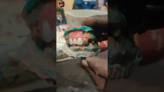 Dental Lab Work  Removal Partial Dentures  Teeth Set  Wax Pattern  Tamil Dental Lab  dentallab [upl. by Irollam573]