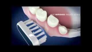 Emmident Ultrasonic Toothbrush  How It Works [upl. by Akerdna]