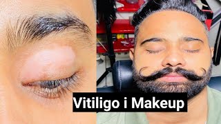 Vitiligo i MAKEUP Tutorial For Man 👨 Mrherobarber 💈💈❤️🔴🇮🇳 [upl. by Aerdnak]