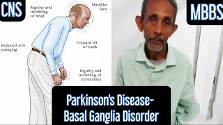 Parkinsons Disease Basal Ganglia Disorder [upl. by Ydnar595]