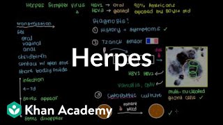 Diagnosis treatment and prevention of herpes  Infectious diseases  NCLEXRN  Khan Academy [upl. by Ynnal41]