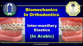 Intermaxillary Elastics in Orthodontics In Arabic [upl. by Estell]