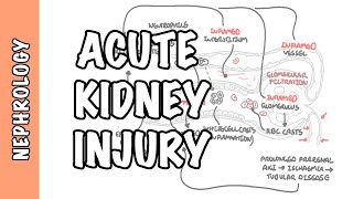 Acute Kidney Injury AKI  prerenal intrarenal and postrenal causes and pathophysiology [upl. by Stanford333]