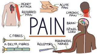 Understanding The Causes of Pain and Pain Management [upl. by Eimia]