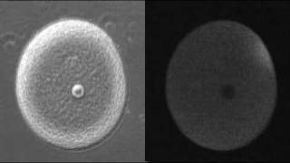 Fertilization  Calcium Wave [upl. by Doowle372]