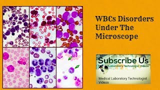 WBC Disorders Under The Microscope [upl. by Ninette]