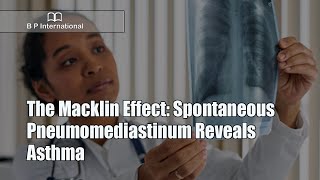 The Macklin Effect Spontaneous Pneumomediastinum Reveals Asthma [upl. by Maleen484]