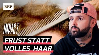 Haartransplantation mit Folgen – Männer leiden nach misslungenen Schönheitseingriffen  Impact  SRF [upl. by Erodavlas]