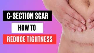 How To Reduce Cesarean Scar Tightness  Cesarean scar reduction technique Powerzen Pilates by Cloë [upl. by Zurc]