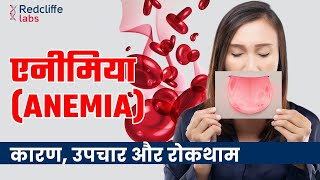 Anemia Symptoms Causes And Treatment In Hindi  शरीर में खून की कमी यानी Anemia कितना ख़तरनाक है [upl. by Bonnice]