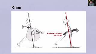 Gait Analysis II [upl. by Miranda]