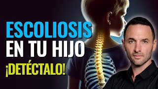 ESCOLIOSIS en tu hijo ¡DETECTALO [upl. by Madella]