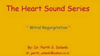 Mitral Regurgitation  Sound [upl. by Ehcar]