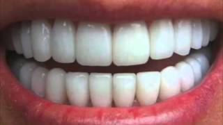 Get Perfectly Straight Teeth―∎ affirmations  Cure Overbite Underbite amp Crossbite [upl. by Olim]