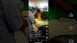 Spinal anesthesia preparation [upl. by Donelu]