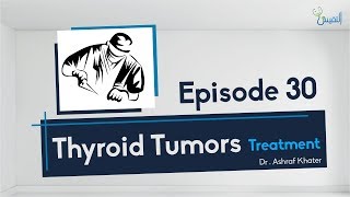 Thyroid Tumor  ManagementampTreatment  04  Surgery  Prof Ashraf Khater [upl. by Eberhart]