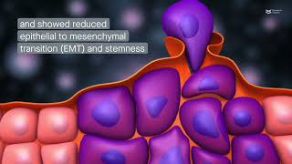 Research  Protein nono promotes the tumorigenicity of breast cancer [upl. by Crocker891]