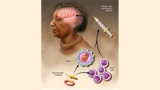 Human gene therapy types of gene therapy part 3 [upl. by Symer]