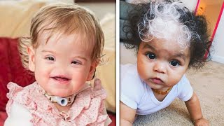 People Born With Incredible Rare Genetic Traits [upl. by Ariahs]