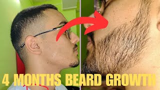 Minoxidil beard growth transformation My 4 months beard growth journey [upl. by Nylehtak]