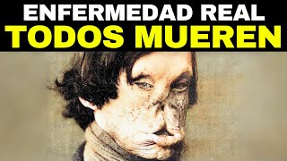 Las 12 Enfermedades Más Terribles De La Historia [upl. by Arhoz]