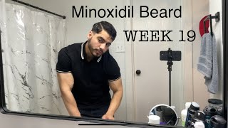 Growing My Beard With Minoxidil Week 19 [upl. by Eelnayr217]