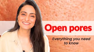 Open pores How to treat  Creams to use  Lasers  Dermatologist Dr Aanchal [upl. by Sparks819]