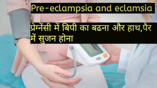 Preeclampsia and eclamsia in hindi [upl. by Airla]