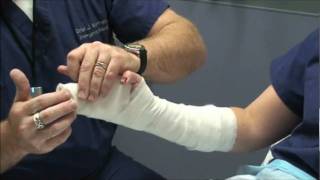 Splint Workshop 3  Ulnar Gutter Splint [upl. by Dao]