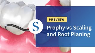 Oral Prophylaxis Step by Step  Dr Gopathi Haritha [upl. by Ardnauq391]