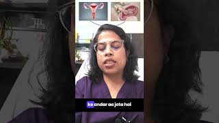 Understanding Ectopic Pregnancy in Hindi [upl. by Lednahs657]