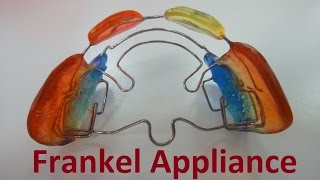 Role of Frankel Appliances by Prof John Mew [upl. by Engelbert]