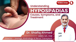 Understanding Hypospadias Causes Symptoms and Treatment  Dr Shafiq Ahmed Hypospadias prostate [upl. by Conn372]